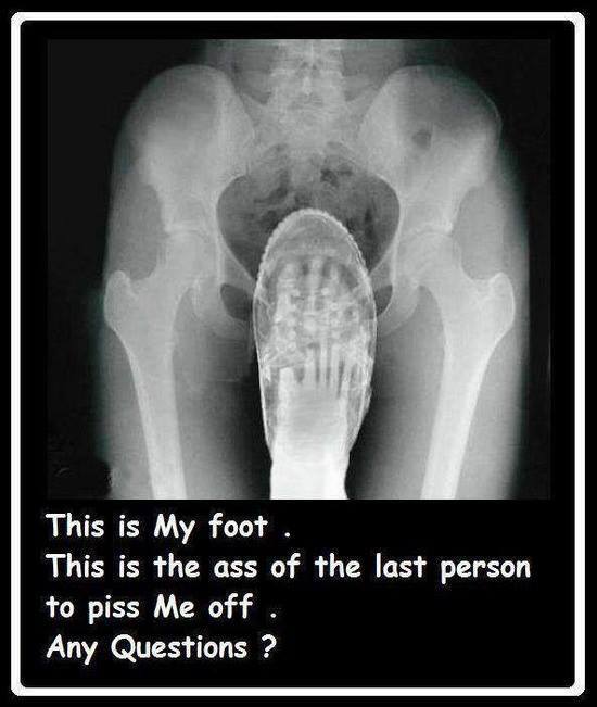 Funny-x-ray.jpg